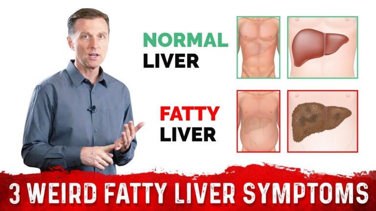 Fatty Liver Disease